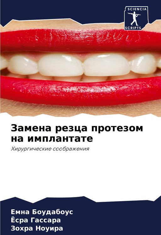 Produktbild: Zamena rezca protezom na implantate