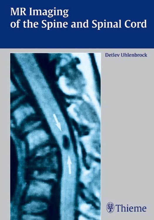 Produktbild: MR Imaging of the Spine and Spinal Cord