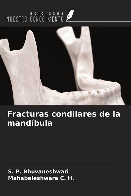 Produktbild: Fracturas condilares de la mand&iacute;bula