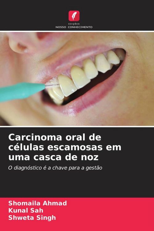 Produktbild: Carcinoma oral de c&eacute;lulas escamosas em uma casca de noz