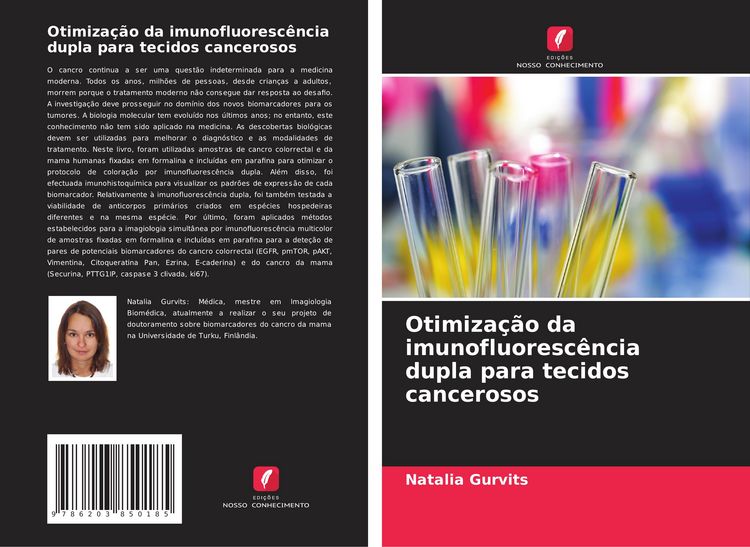Produktbild: Otimiza&ccedil;&atilde;o da imunofluoresc&ecirc;ncia dupla para tecidos cancerosos
