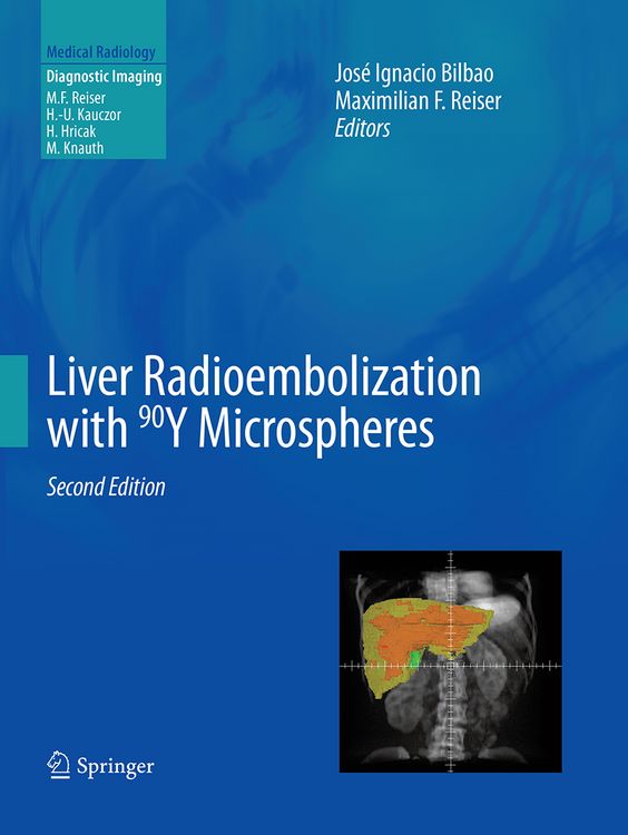 Produktbild: Liver Radioembolization with 90Y Microspheres