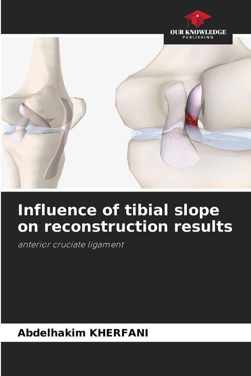 Produktbild: Influence of tibial slope on reconstruction results