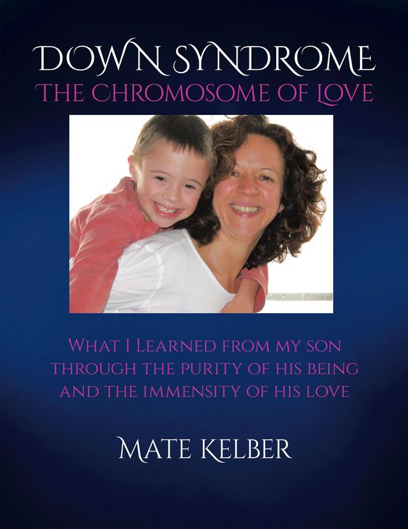 Produktbild: DOWN SYNDROME The Chromosome of Love