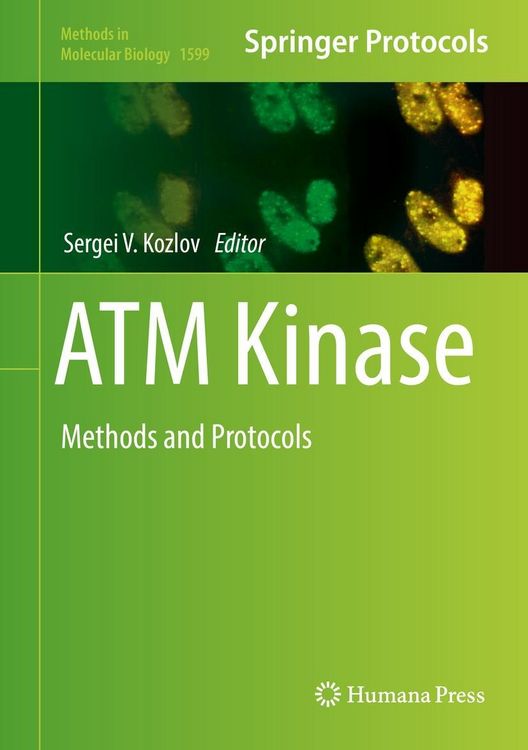 Produktbild: ATM Kinase