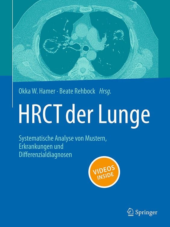 Produktbild: HRCT der Lunge