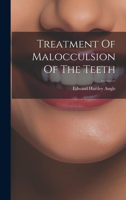 Produktbild: Treatment Of Malocculsion Of The Teeth