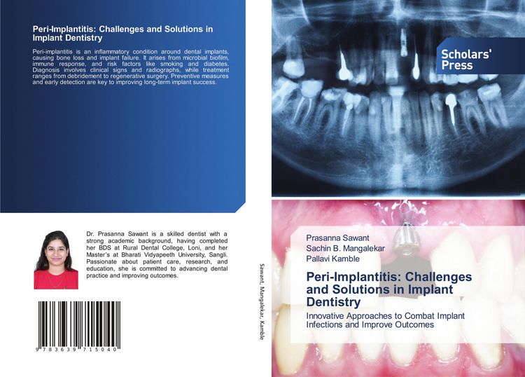 Produktbild: Peri-Implantitis: Challenges and Solutions in Implant Dentistry