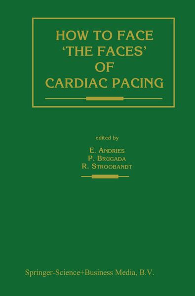 Produktbild: How to face &lsquo;the faces&rsquo; of CARDIAC PACING