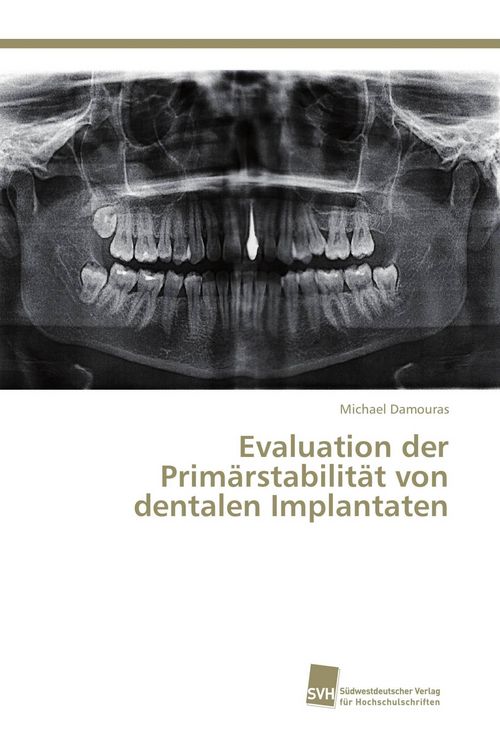 Produktbild: Evaluation der Prim&auml;rstabilit&auml;t von dentalen Implantaten