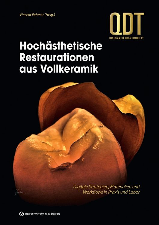 Produktbild: Hoch&auml;sthetische Restaurationen aus Vollkeramik