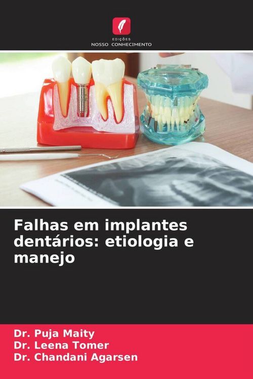 Produktbild: Falhas em implantes dent&aacute;rios: etiologia e manejo