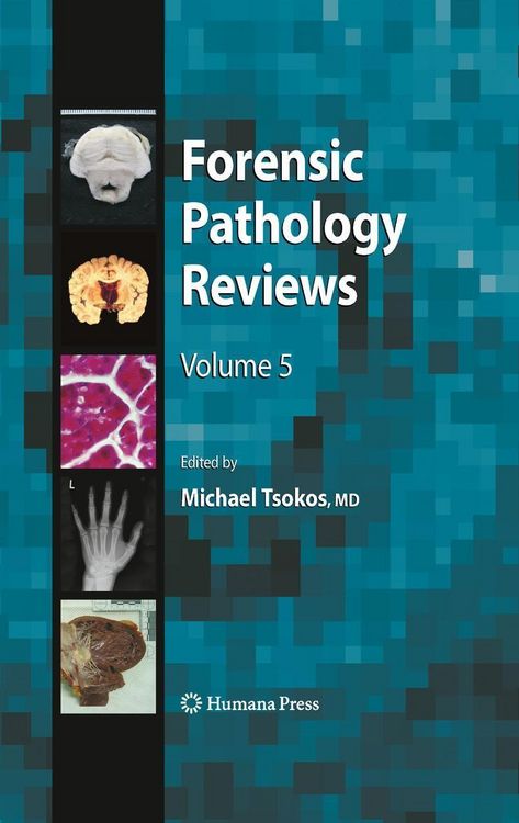 Produktbild: Forensic Pathology Reviews 5