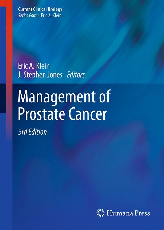 Produktbild: Management of Prostate Cancer