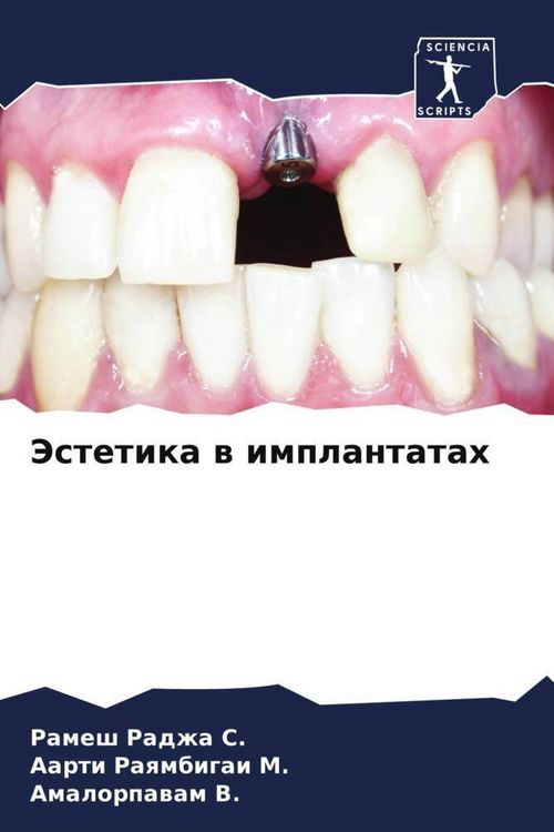 Produktbild: Jestetika w implantatah