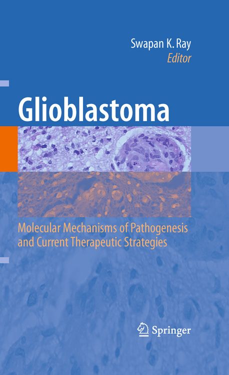 Produktbild: Glioblastoma: