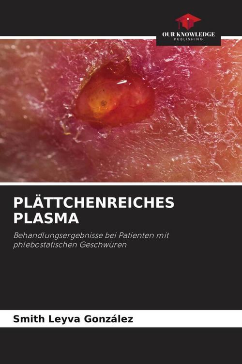 Produktbild: Pl&auml;ttchenreiches Plasma