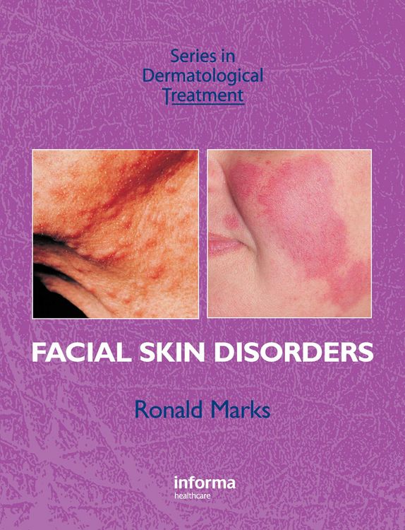 Produktbild: Facial Skin Disorders