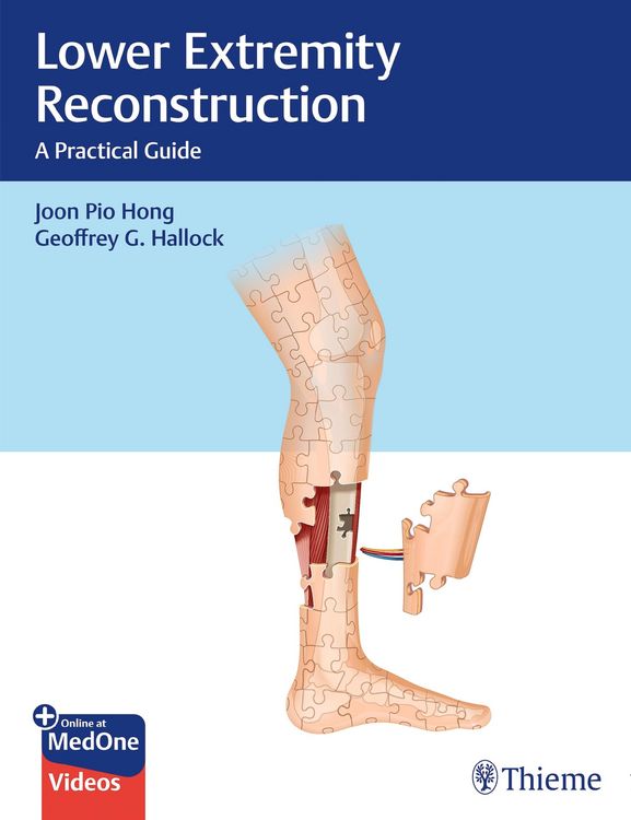 Produktbild: Lower Extremity Reconstruction