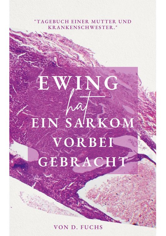 Produktbild: Ewing hat ein Sarkom vorbeigebracht