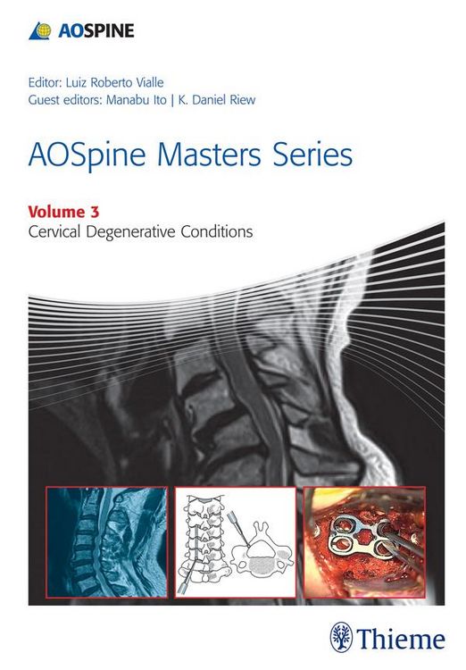 Produktbild: AOSpine Masters Series, Volume 3: Cervical Degenerative Conditions