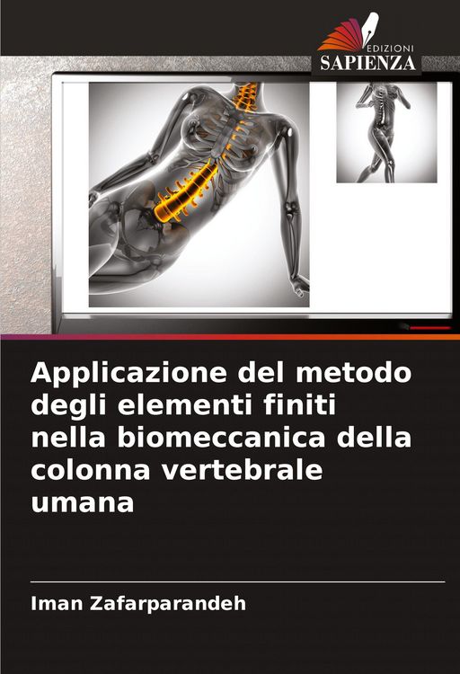 Produktbild: Applicazione del metodo degli elementi finiti nella biomeccanica della colonna vertebrale umana