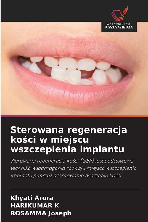 Produktbild: Sterowana regeneracja ko&iquest;ci w miejscu wszczepienia implantu
