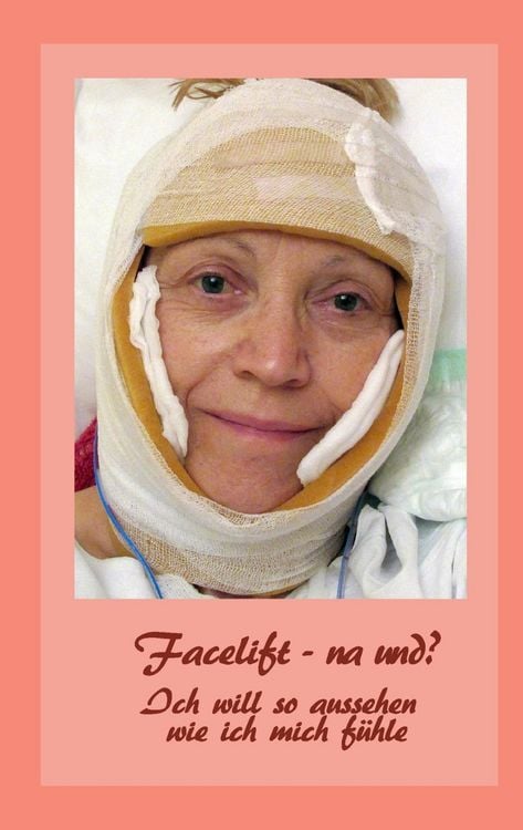Produktbild: Facelift - na und?