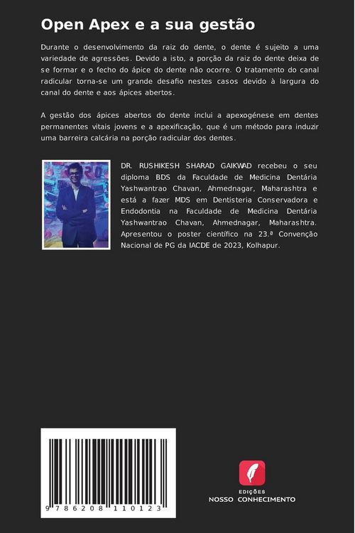 Produktbild: Open Apex e a sua gest&atilde;o
