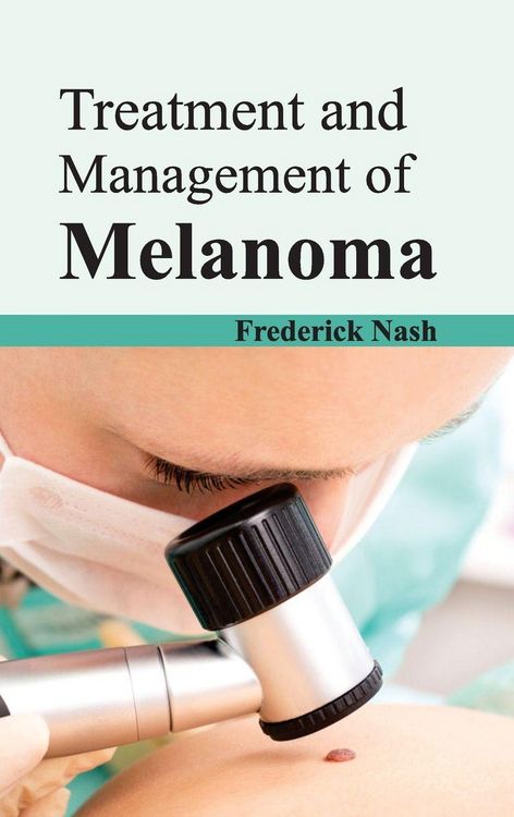 Produktbild: Treatment and Management of Melanoma