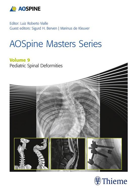 Produktbild: AOSpine Masters Series, Volume 9: Pediatric Spinal Deformities