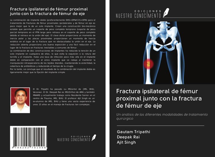 Produktbild: Fractura ipsilateral de f&eacute;mur proximal junto con la fractura de f&eacute;mur de eje