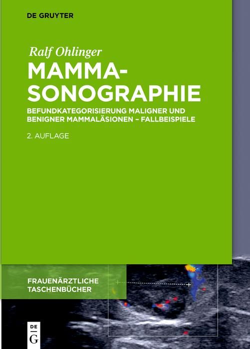 Produktbild: Mammasonographie