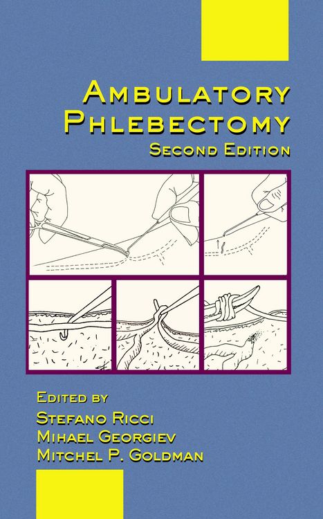 Produktbild: Ambulatory Phlebectomy