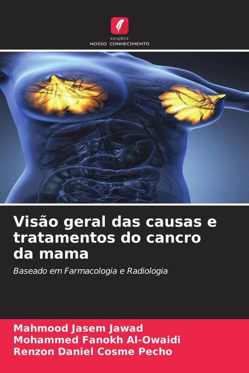 Produktbild: Vis&atilde;o geral das causas e tratamentos do cancro da mama