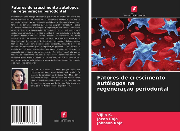 Produktbild: Fatores de crescimento aut&oacute;logos na regenera&ccedil;&atilde;o periodontal