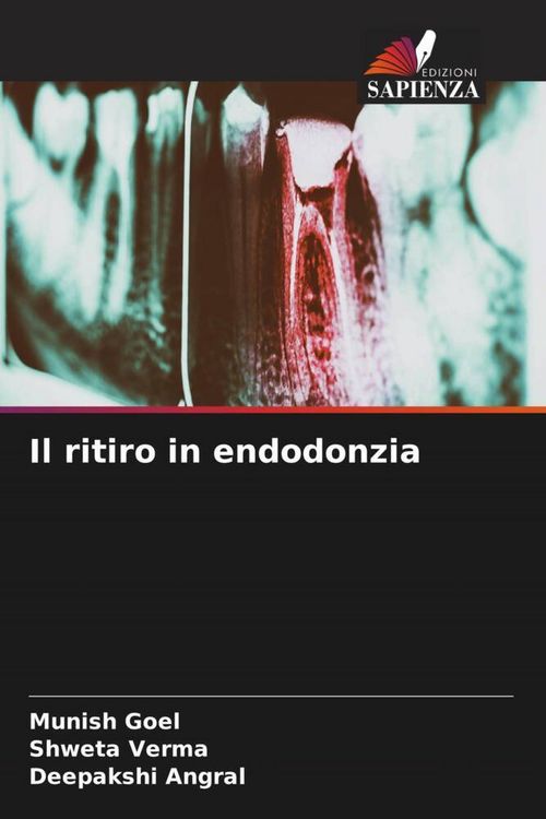 Produktbild: Il ritiro in endodonzia
