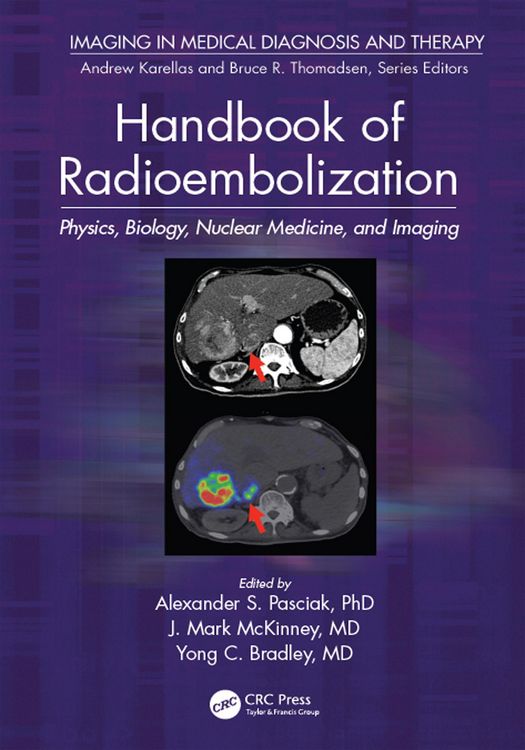 Produktbild: Handbook of Radioembolization