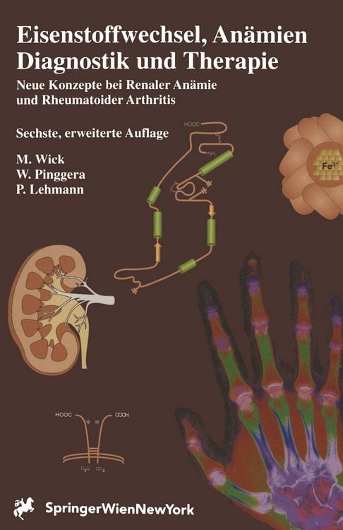Produktbild: Eisenstoffwechsel, An&auml;mien Therapie und Diagnose