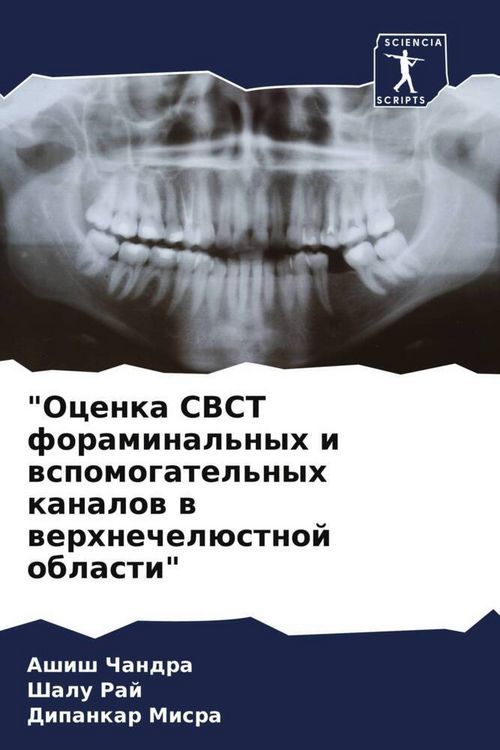Produktbild: "Ocenka CBCT foraminal'nyh i wspomogatel'nyh kanalow w werhnechel&uuml;stnoj oblasti"