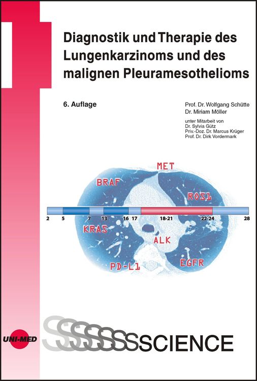 Bild vom Artikel Diagnostik und Therapie des Lungenkarzinoms und des malignen Pleuramesothelioms vom Autor Wolfgang Schütte