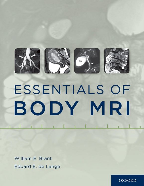 Produktbild: Essentials of Body MRI