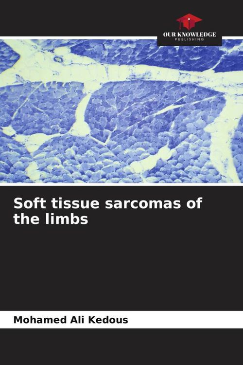 Produktbild: Soft tissue sarcomas of the limbs