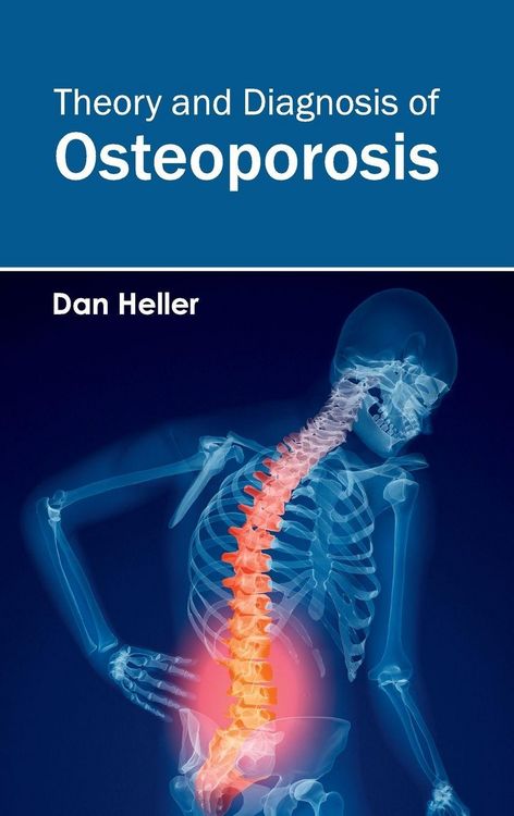 Produktbild: Theory and Diagnosis of Osteoporosis