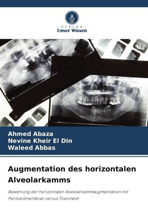 Produktbild: Augmentation des horizontalen Alveolarkamms