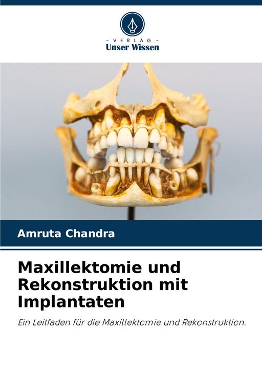 Produktbild: Maxillektomie und Rekonstruktion mit Implantaten