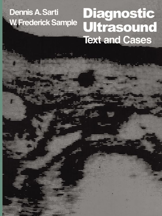 Produktbild: Diagnostic Ultrasound