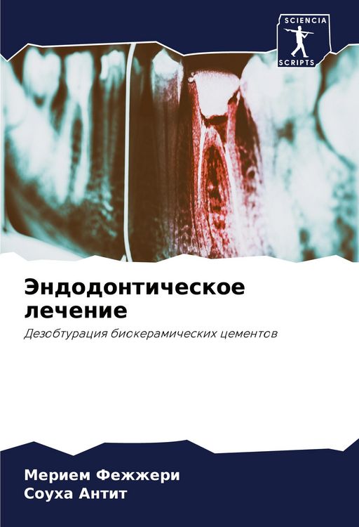 Produktbild: Jendodonticheskoe lechenie