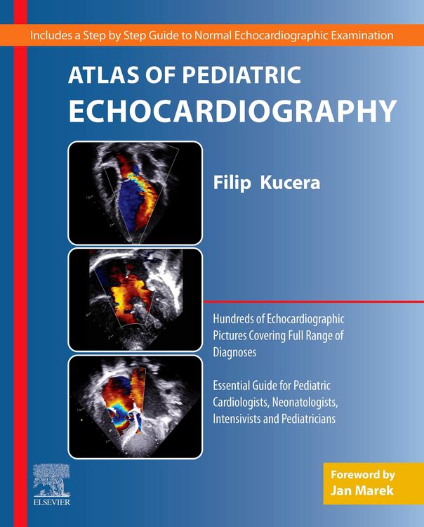 Produktbild: Atlas of Pediatric Echocardiography