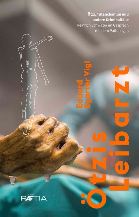 Produktbild: &Ouml;tzis Leibarzt